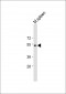 TBX6 Antibody (Center)