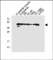 MyoD1 Antibody (Center)