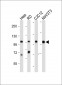 ULK1 Antibody (Center S317)