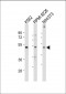 MEF2C Antibody (S387)