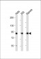 RSK2 (RPS6KA3) Antibody (N-term)