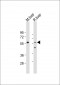 SCP2 Antibody (Center)