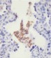 PD L1 Monoclonal  Antibody (PDL1)
