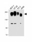 CEA Antibody (Center)