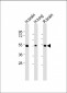 DUSP6 Antibody (Center)