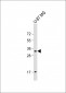 GGH Antibody (N-term)