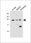 Erythropoietin Antibody