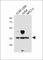 TAL1 Antibody (T90)