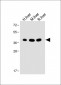 OTC Antibody (Center)