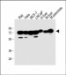 CBS Antibody (Center)