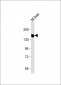 INSR(Insulin Receptor) Antibody (N-term)