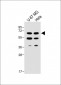 UGT8 antibody (Center)