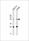 FOXN3 Antibody (C-term)