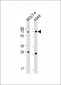 NEIL3 Antibody(Center)