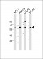 XIAP (BIRC4) Antibody (N-term)