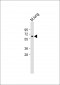 MMP14 Antibody (N-term)