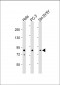 DYRK1A Antibody (N-term)