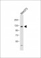 FGFR4 Antibody (N-term)