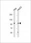 NUP210 Antibody (N-term)