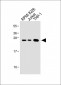 Bcl-2 Antibody (BH3 Domain Specific)