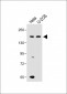 KDM6B Antibody (N-term)