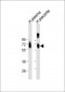 SPP1 Antibody (C-term)