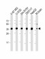 EN1 (Engrailed 1) Antibody (N-term)