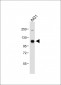 DDR1 Antibody (Center)