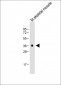 CTSK Antibody (Center R222)