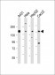 CCK4 (PTK7) Antibody (N-term)
