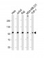 NLRP3 Antibody (N-term)