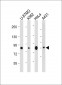 PLOD1 Antibody (C-term)