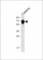 SERPINA6 Antibody (Center)