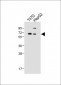 SERPINA6 Antibody (Center)