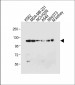 ROR1 Antibody