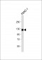 ROR1 Antibody