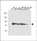 GUSB Antibody (Center)