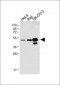 PAX8 Antibody (Center)