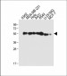 TUBB6 Antibody (Center)