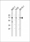 ESR1/ER Antibody (Center)