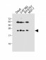 PRL Antibody (Center)