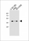 PCGF6 Antibody (Center)