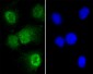 T Antibody (N-term)