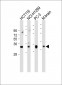 VDAC2 Antibody (N-term)