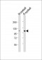 RB(S612) Antibody