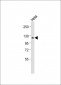 RB(S612) Antibody