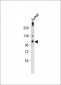 RB(S612) Antibody