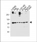 FGFR(Y766) Antibody