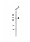 VTN Antibody (N-term)