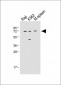 IRAK3 Antibody (N-term)